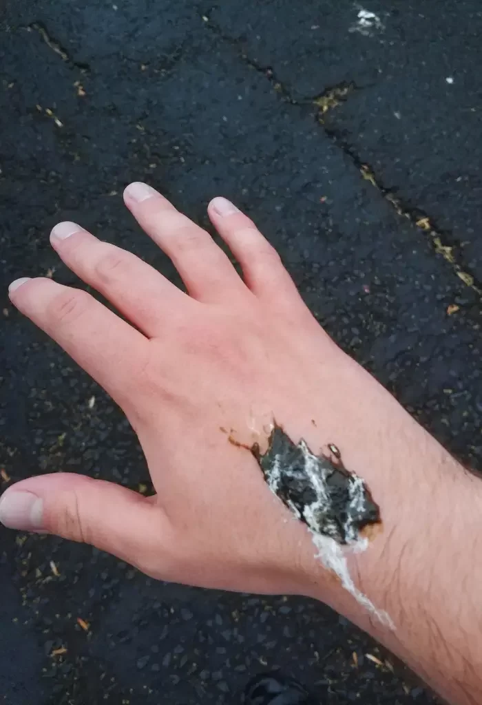 Close-up of a hand with bird droppings on it, against a background of asphalt.